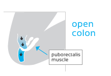 diagrams-open-colon